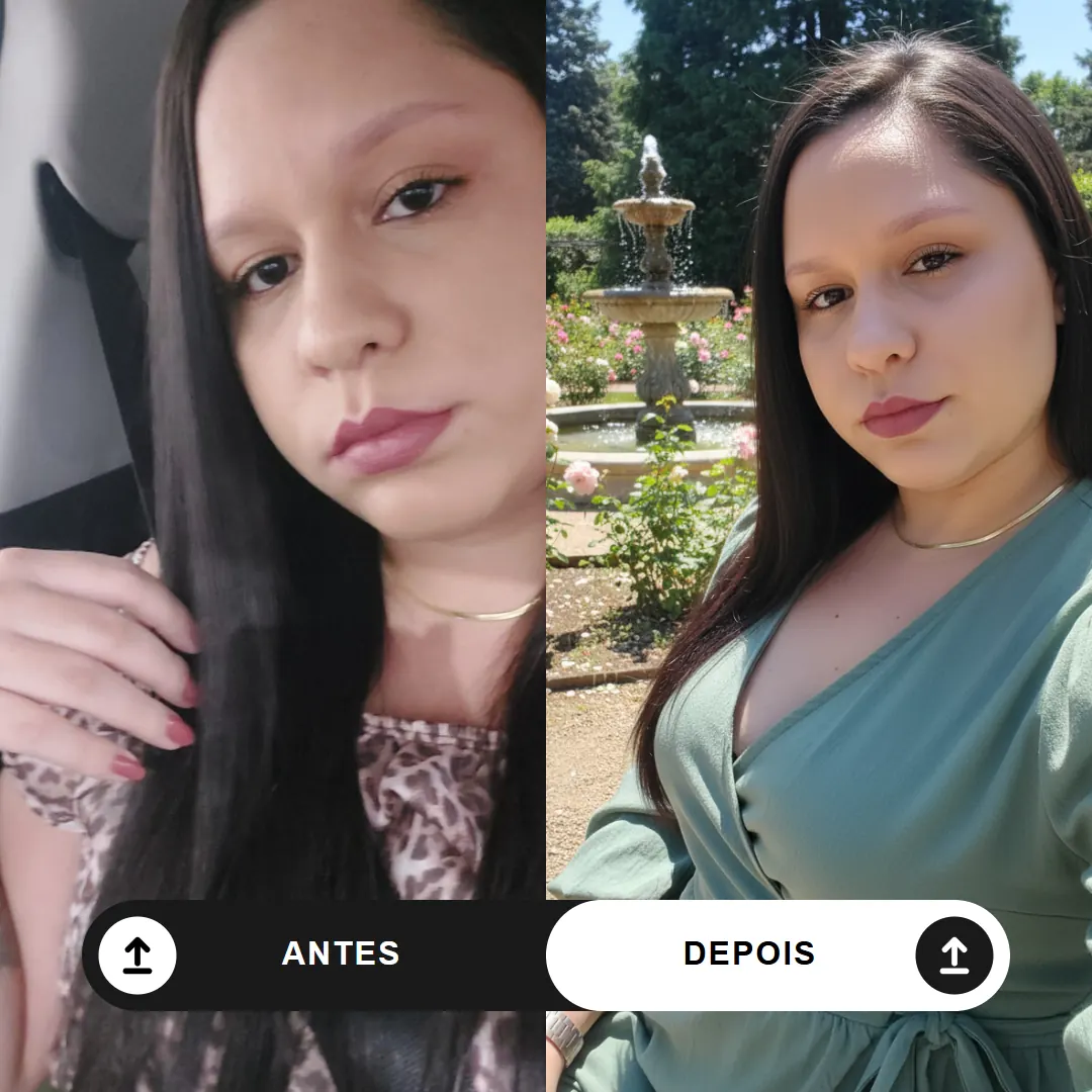 Comparação antes e depois — exemplo 5